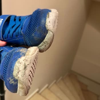Skechers Bir Haftada Parçalanmış Ayakkabı Çöp Oldu