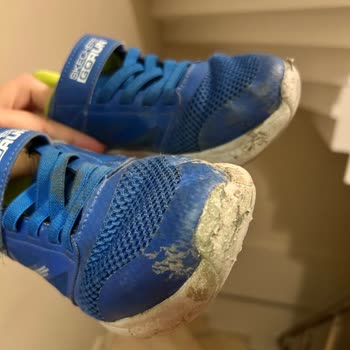 Skechers Bir Haftada Parçalanmış Ayakkabı Çöp Oldu