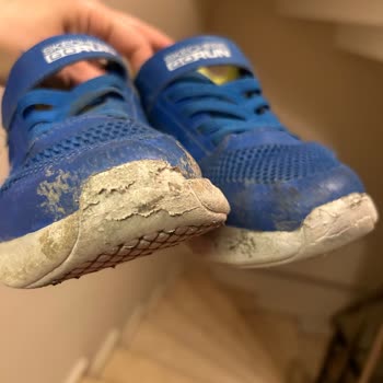 Skechers Bir Haftada Parçalanmış Ayakkabı Çöp Oldu
