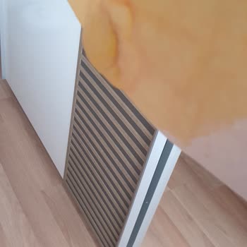 Sevgi Medlife Estetik Ankara Ems Cihazıyla Kolumu Yaktı