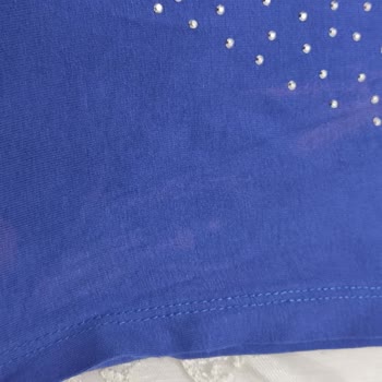 Tereson Cildimde Ve Kıyafetimde Renk Değişikliği Yaptı