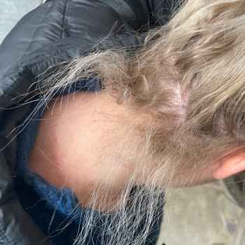 Furkan Gültekin Kuaför Mahvetti Saçlarımı Yaktı Rengi Çok Kötü Oldu