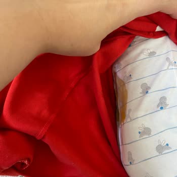 Molfix Bebek Bezi Sızdırma Sorunu