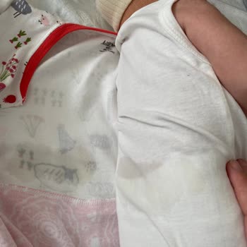 Molfix Bebek Bezi Sızdırma Sorunu