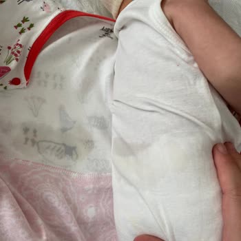 Molfix Bebek Bezi Sızdırma Sorunu