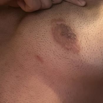 Gülsüm Sözen Beauty Academy Estetik Sonrası Kamuflaj Uygulaması Ve Müşteri Memnuniyetsizliği