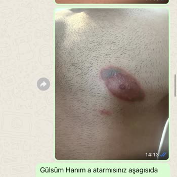 Gülsüm Sözen Beauty Academy Estetik Sonrası Kamuflaj Uygulaması Ve Müşteri Memnuniyetsizliği