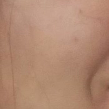 Koreaco Serumları Leke Yaptı