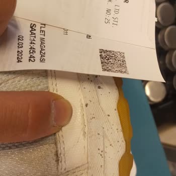 My New Skechers Shoes Deformed After Little Use