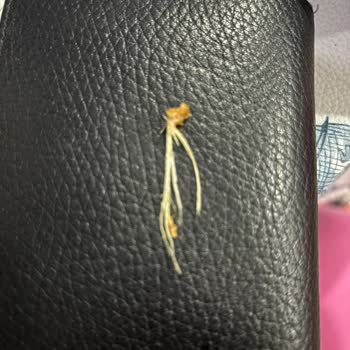 Doğuş Çay Patates Cipsi Paketinde Beklenmedik Madde Bulma Deneyimi