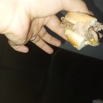Yemeksepeti Yemekte Saç Kılı Çıktı