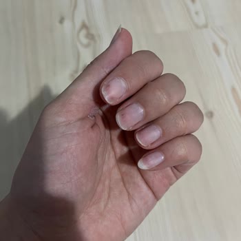 Eskişehir Espark Gratis Beauty Kalıcı Oje Sonrası Hasar