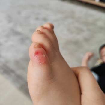 FLO Ayakkabı Lumberjack Marka Ayakkabı Sorunu Ve FLO İlgisizliği