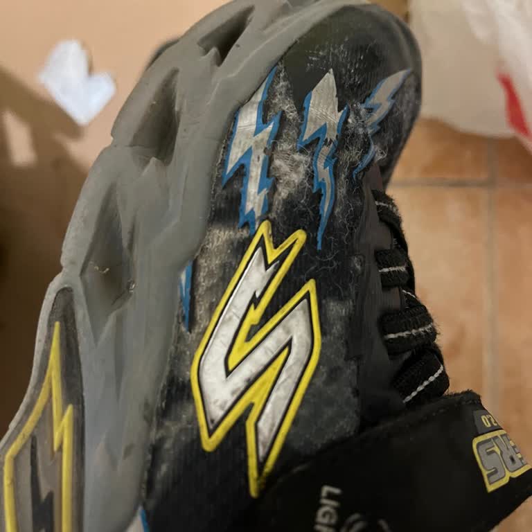 Skechers Ayakkabıda Deformasyon Olması