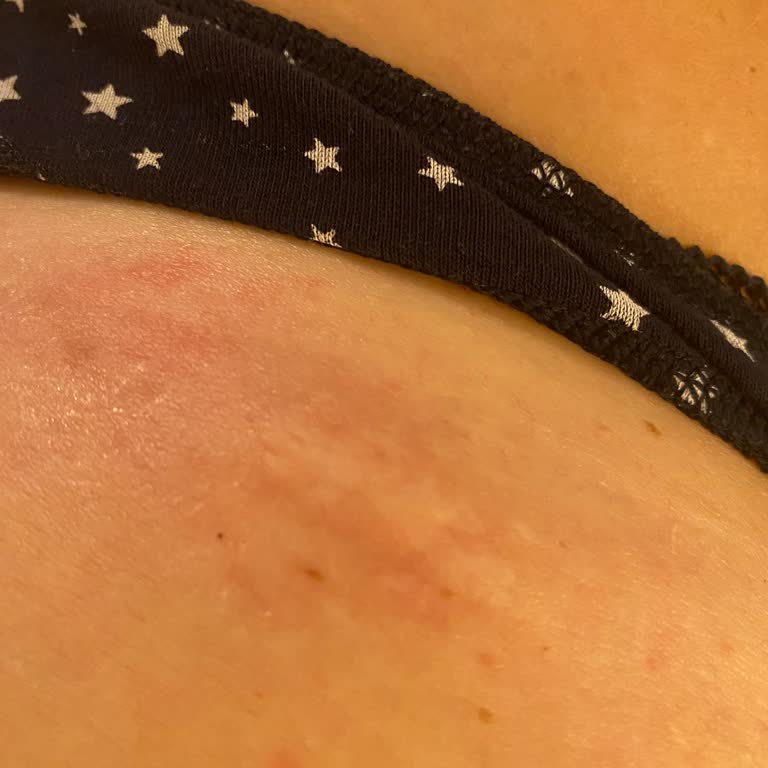 Dekolte Plus Güzellik ve Zayıflama Merkezi Güzellik Salonunda Yaşanan Sorunlar Ve Geri Ödeme Talebi