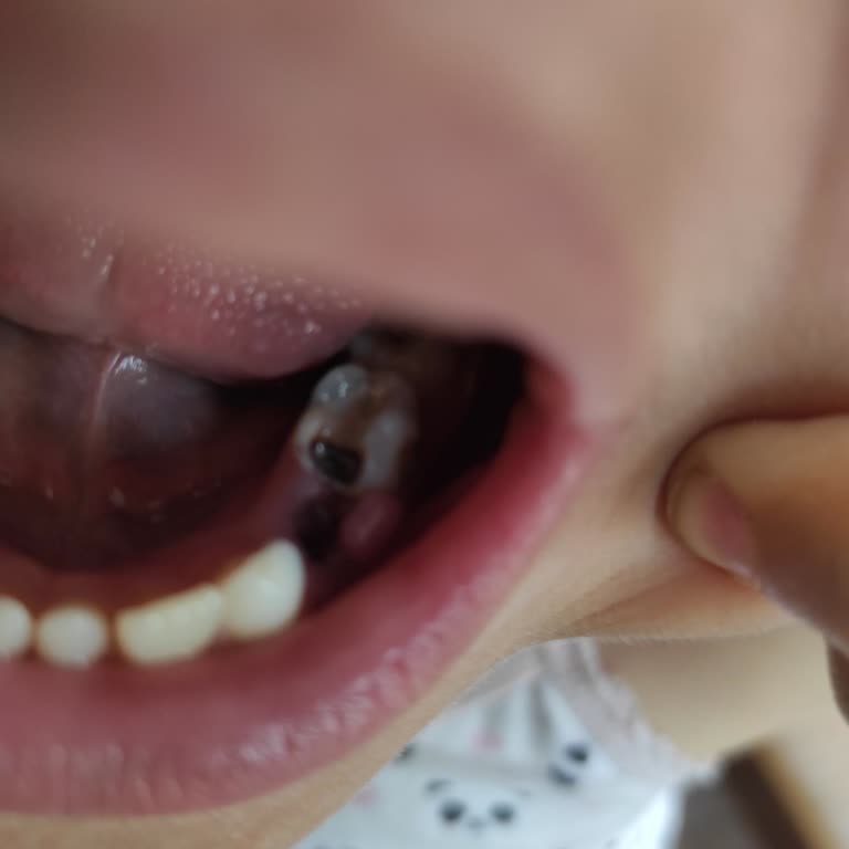 Alsancak Diş Hastanesi DT. Şikayeti