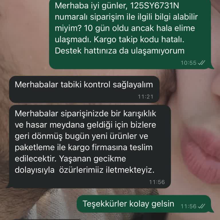 Bade Natural Ürünüm Bana 13 Gündür Ulaşmadı