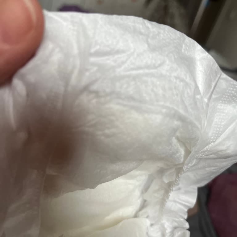 Sleepy Bez Dokusu Yüzünden Bebeğimin Cildini Tahriş Etti