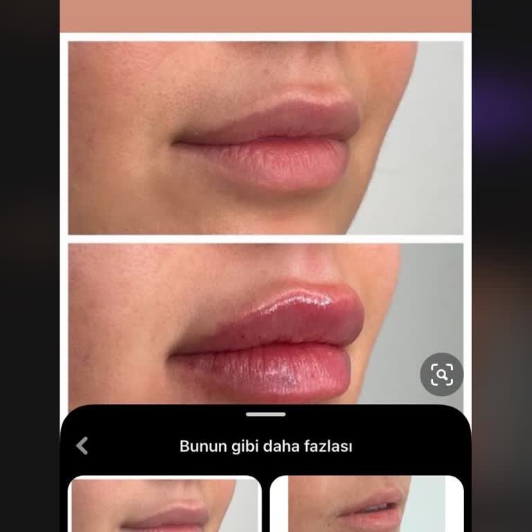 Shine Beauty (Buca) Resim Kullanıyorlar