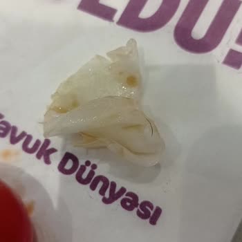 Tavuk Dünyası Menümde Kıl Çıktı, Domates Kurtluydu