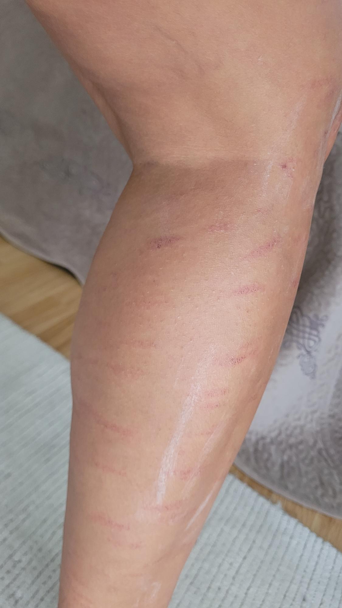 Egizaklarning katta nipellari fotosuratlari