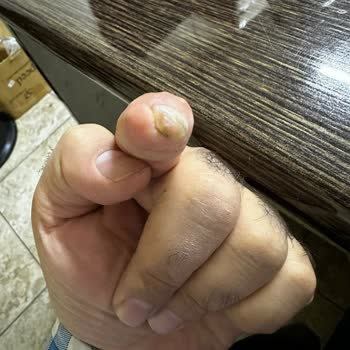 Deva Hastanesi Ameliyat Pişmanlığı