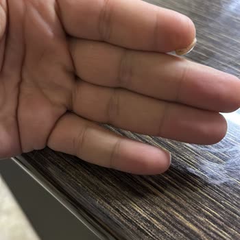 Deva Hastanesi Ameliyat Pişmanlığı