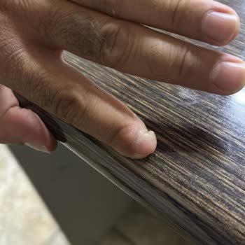 Deva Hastanesi Ameliyat Pişmanlığı