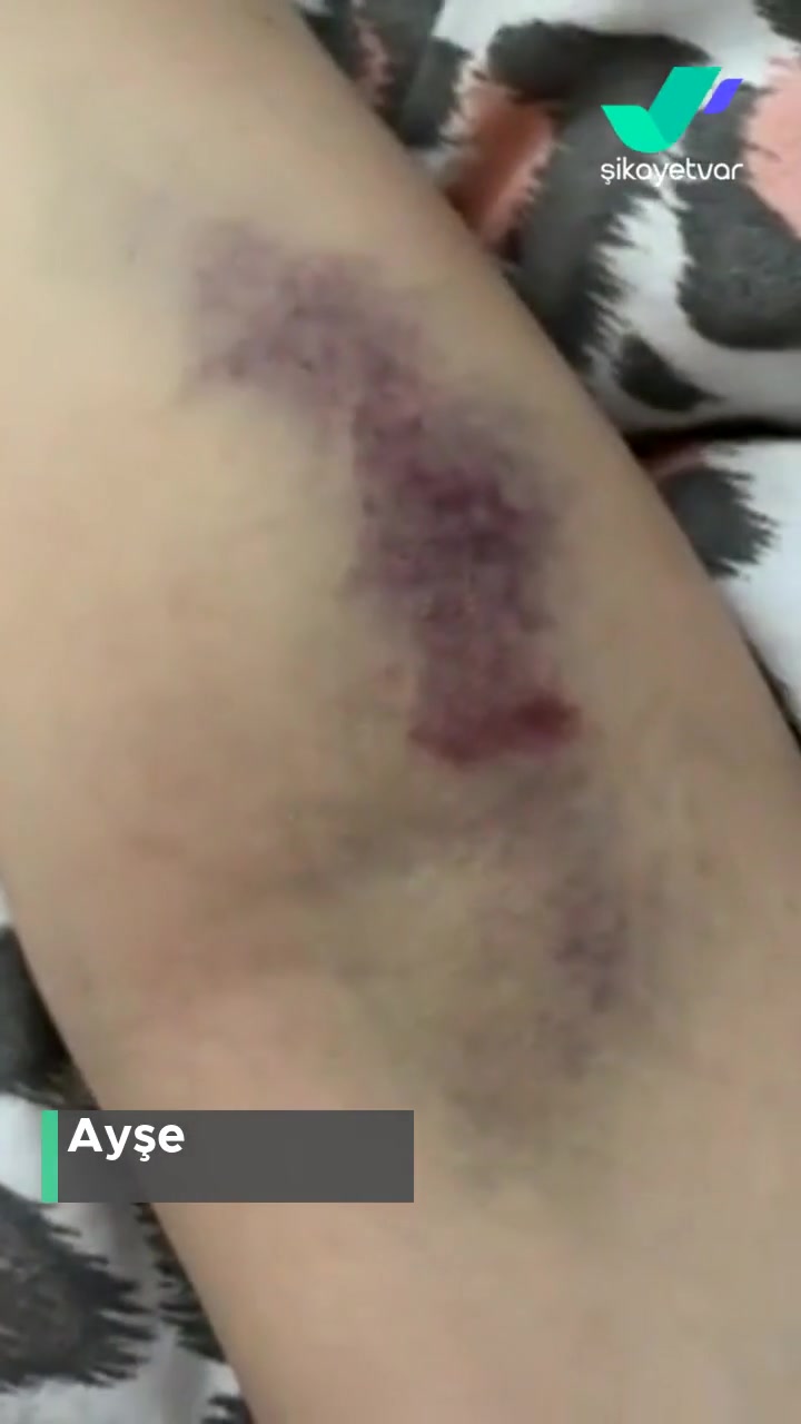 Marmara Üniversitesi Pendik Eğitim Ve Araştırma Hastanesi  Kan Tahlili videonun kapak resmi