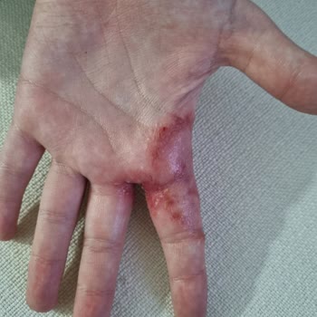 FSM Tıp Merkezi - Kavacık Yanlış Teşhisten Dolayı Memnun Kalmadık