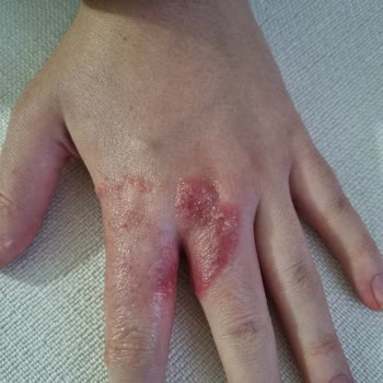 FSM Tıp Merkezi - Kavacık Yanlış Teşhisten Dolayı Memnun Kalmadık