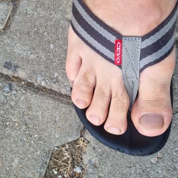 Ceyo Terlikler Parmak Arası Rahatsızlığı