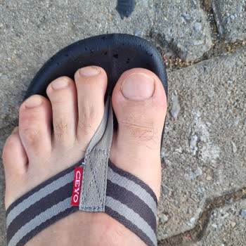 Ceyo Terlikler Parmak Arası Rahatsızlığı