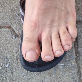 Ceyo Terlikler Parmak Arası Rahatsızlığı