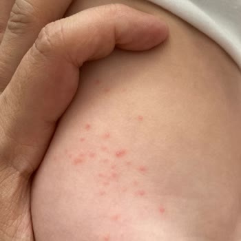 Sleepy Ekolojik Bebek Bezi Pişmanlığı!