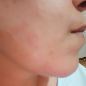 The Purest Solutions Marka Sesimizi Duysun