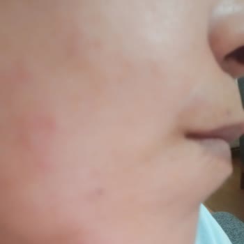 The Purest Solutions Marka Sesimizi Duysun