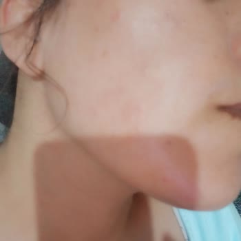 The Purest Solutions Marka Sesimizi Duysun