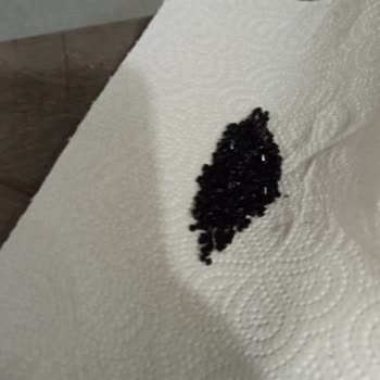 Filiz Başol Özel Günüm İçin Aldığım Takımda Boncuk Dökülmesi Sorunu