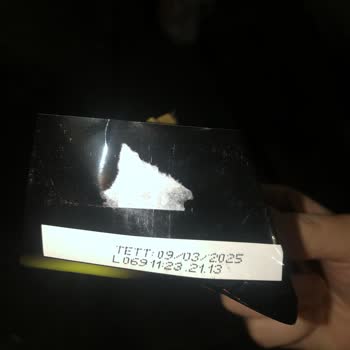 Eti Gıda Eti Karam Şikayet