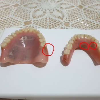 Dental İmplant Clinic Özel Yüceler Ağız Ve Diş Sağlığı Dental Implant Clinic A Plus