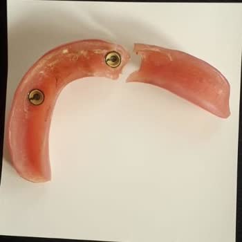 Dental İmplant Clinic Özel Yüceler Ağız Ve Diş Sağlığı Dental Implant Clinic A Plus