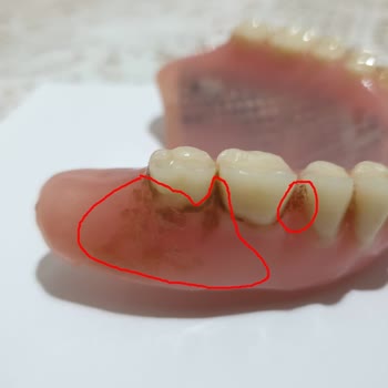 Dental İmplant Clinic Özel Yüceler Ağız Ve Diş Sağlığı Dental Implant Clinic A Plus