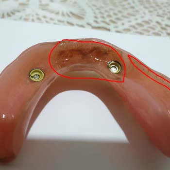 Dental İmplant Clinic Özel Yüceler Ağız Ve Diş Sağlığı Dental Implant Clinic A Plus