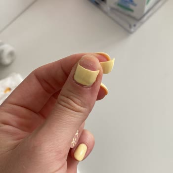 ForNail Studio Kalıcı Oje Hizmetinde Yaşadığım Sorun Ve Yetersiz Destek