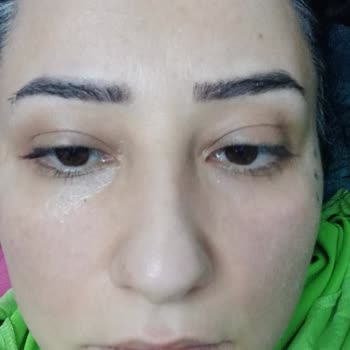 Eki aç
