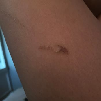 Erdinç Batal Beauty Yeni Adı Pera Life Yaktılar!