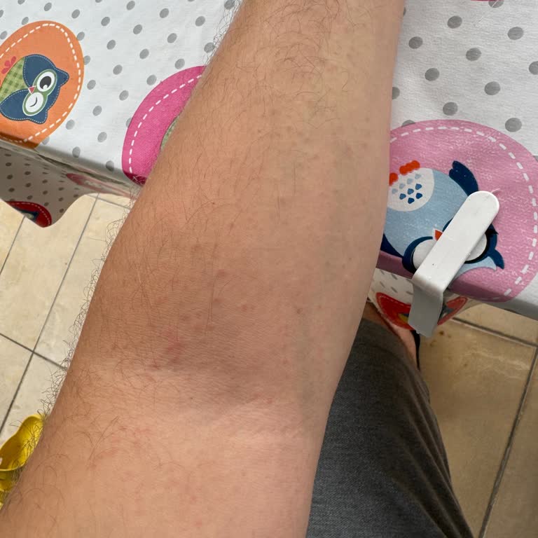 Defans Sinek Kovucu Vücutta Oluşan Zarar Ve Alerji