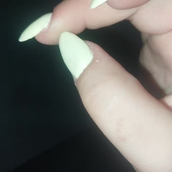 Balerin Tırnak Pişmanlığı