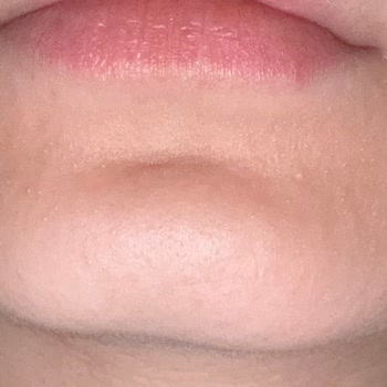 The Purest Solutions The Purest Cilt Bakım Ürünleri